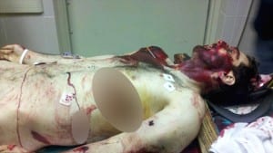 Tamerlan, lying dead from wounds received in encounters with the police.
