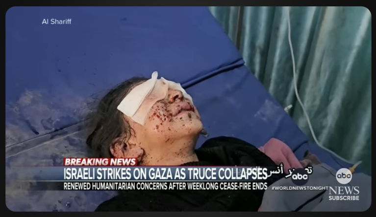 Gaza child wounded 2023